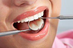 A woman getting a dental exam at Encinitas Periodontics & Dental Implants in Encinitas, CA